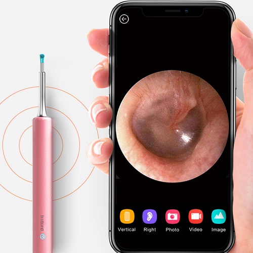 Xiaomi Bebird Smart Visual Ear Cleaner C3 Pink