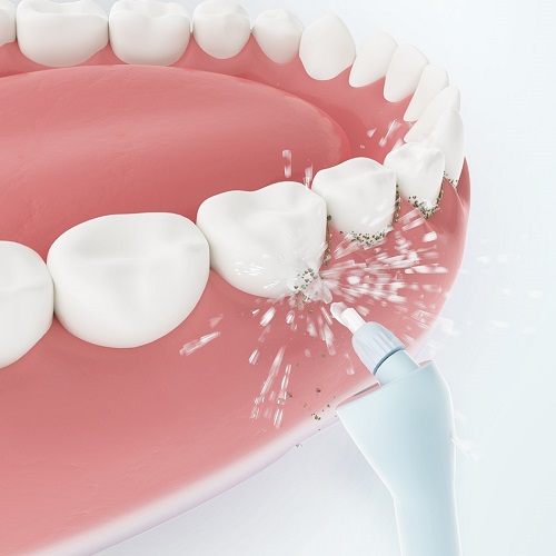Xiaomi SUNUO C3 Pro Intelligent Visual Oral Irrigator White