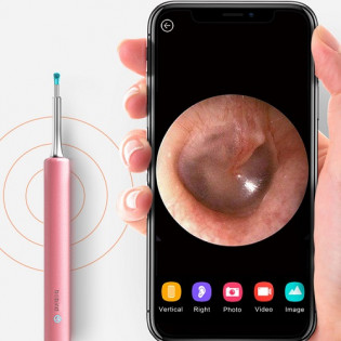 Xiaomi Bebird Smart Visual Ear Cleaner C3 Pink