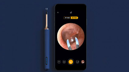 Smart Ear Pick By Bebird